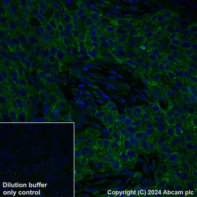 Immunohistochemistry (Formalin/PFA-fixed paraffin-embedded sections) - Alexa Fluor® 488 Anti-MTHFD2 antibody [EPR26938-20] (AB317663)