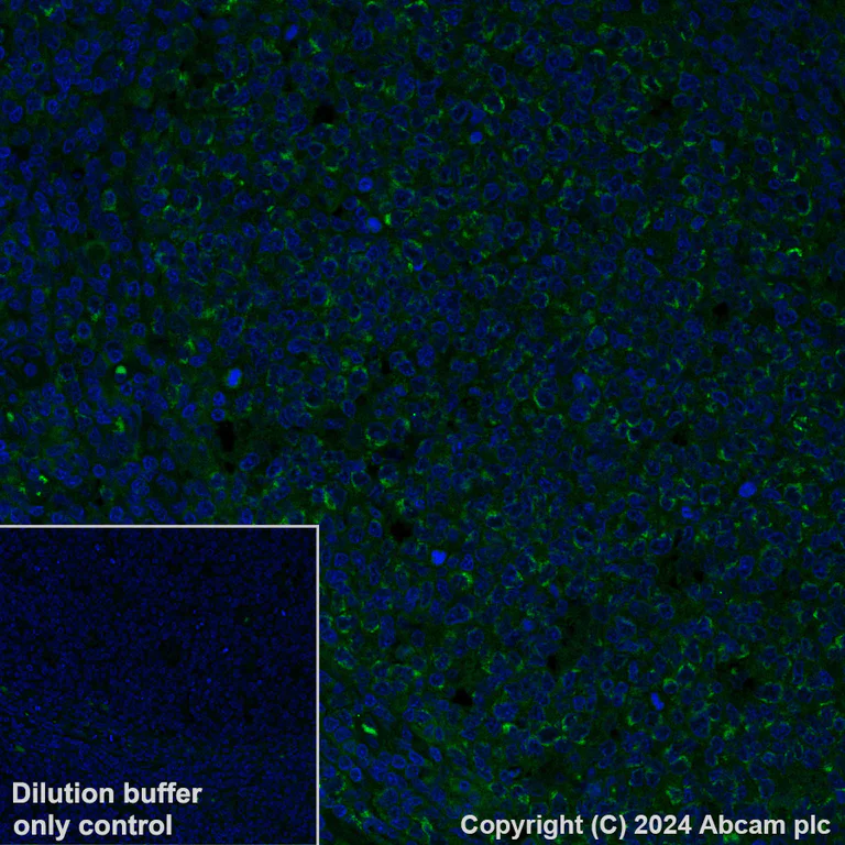 Immunohistochemistry (Formalin/PFA-fixed paraffin-embedded sections) - Alexa Fluor® 488 Anti-MTHFD2 antibody [EPR26938-20] (AB317663)