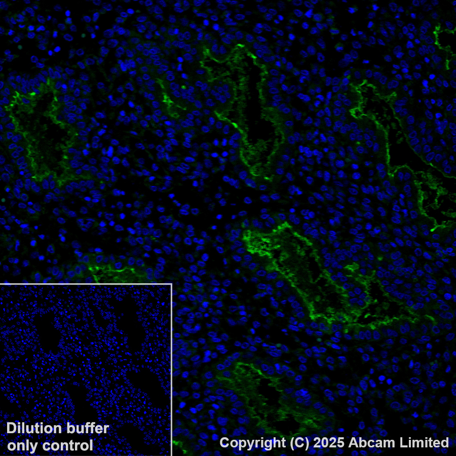 Immunohistochemistry (Formalin/PFA-fixed paraffin-embedded sections) - Alexa Fluor® 488 Anti-MUC1 antibody [EPR1023] (AB196443)