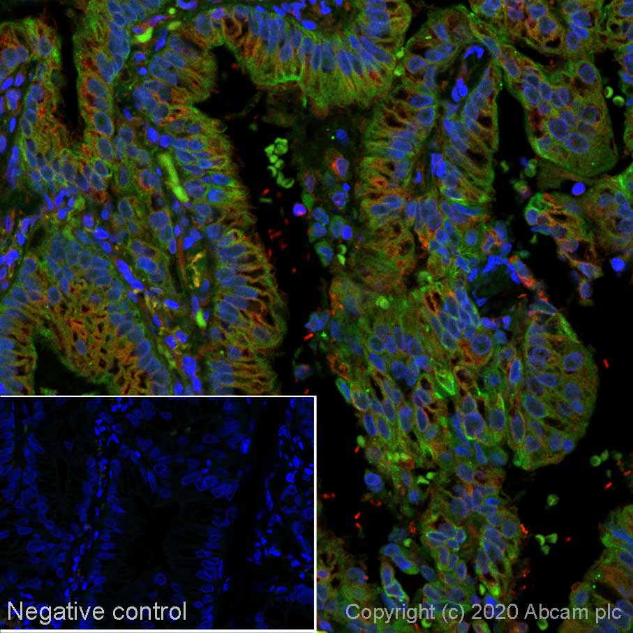 Immunohistochemistry (Formalin/PFA-fixed paraffin-embedded sections) - Alexa Fluor® 488 Anti-MUC4 antibody [SP241] (AB267546)