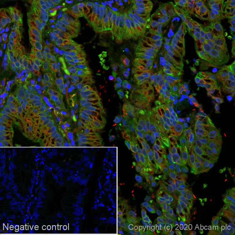 Immunohistochemistry (Formalin/PFA-fixed paraffin-embedded sections) - Alexa Fluor® 488 Anti-MUC4 antibody [SP241] (AB267546)