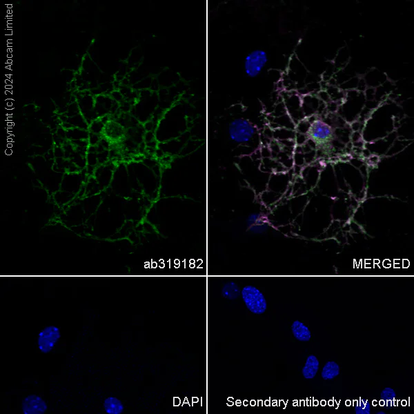 Immunocytochemistry/ Immunofluorescence - Alexa Fluor® 488 Anti-Myelin PLP antibody [EPR23504-106] (AB319182)