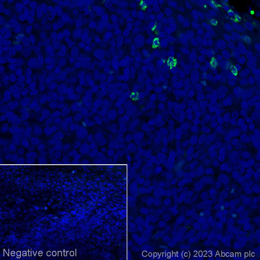 Immunohistochemistry (Formalin/PFA-fixed paraffin-embedded sections) - Alexa Fluor® 488 Anti-Myeloperoxidase antibody [SP72] (AB314281), expandable thumbnail
