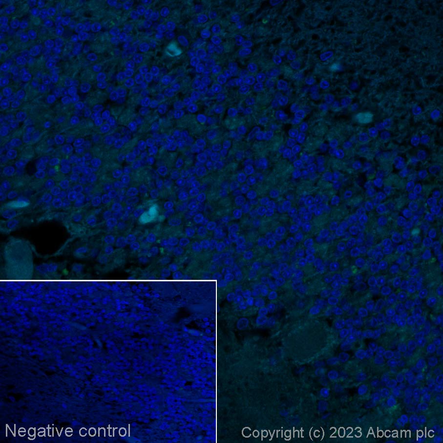 Immunohistochemistry (Formalin/PFA-fixed paraffin-embedded sections) - Alexa Fluor® 488 Anti-Myeloperoxidase antibody [SP72] (AB314281), expandable thumbnail
