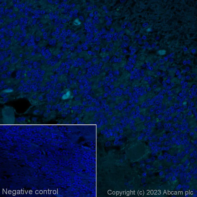 Immunohistochemistry (Formalin/PFA-fixed paraffin-embedded sections) - Alexa Fluor® 488 Anti-Myeloperoxidase antibody [SP72] (AB314281)