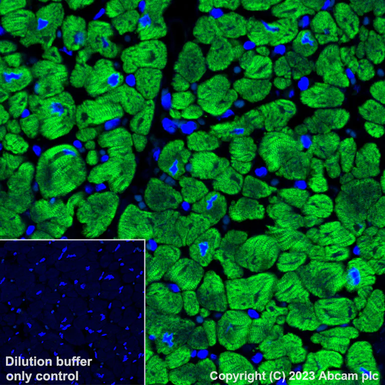 Immunohistochemistry (Formalin/PFA-fixed paraffin-embedded sections) - Alexa Fluor® 488 Anti-Myosin heavy chain antibody [A4.1025] (AB315962)