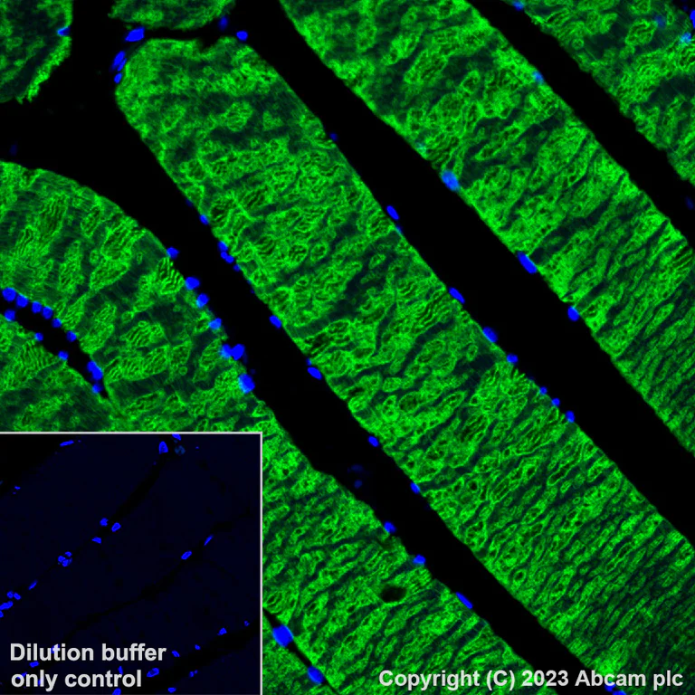 Immunohistochemistry (Formalin/PFA-fixed paraffin-embedded sections) - Alexa Fluor® 488 Anti-Myosin heavy chain antibody [A4.1025] (AB315962)