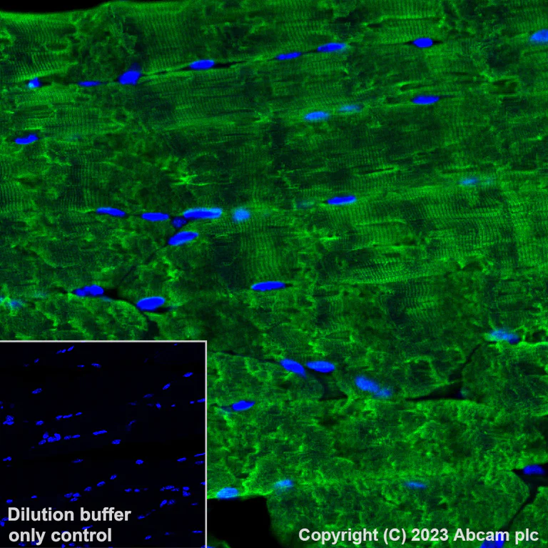 Immunohistochemistry (Formalin/PFA-fixed paraffin-embedded sections) - Alexa Fluor® 488 Anti-Myosin heavy chain antibody [A4.1025] (AB315962)