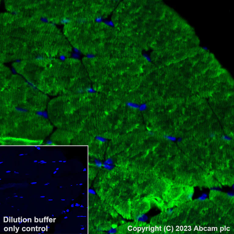Immunohistochemistry (Formalin/PFA-fixed paraffin-embedded sections) - Alexa Fluor® 488 Anti-Myosin heavy chain antibody [A4.1025] (AB315962)