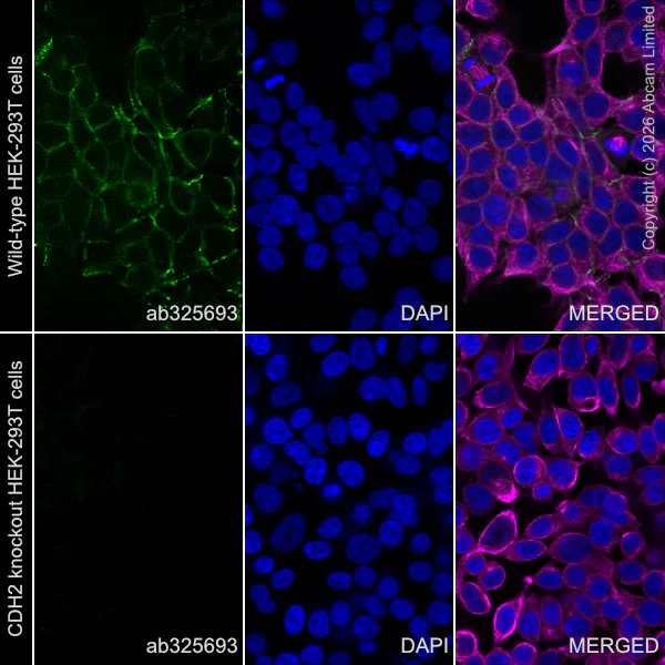Immunocytochemistry/ Immunofluorescence - Alexa Fluor® 488 Anti-N Cadherin antibody [EPR29626-10] (AB325693)