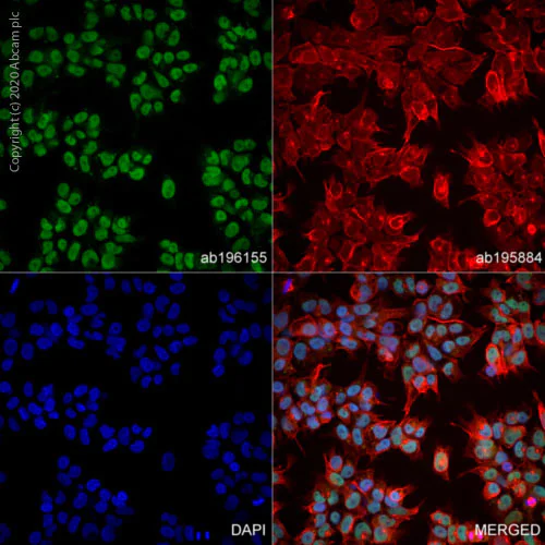 Immunocytochemistry/ Immunofluorescence - Alexa Fluor® 488 Anti-Nanog antibody [EPR2027(2)] (AB196155)