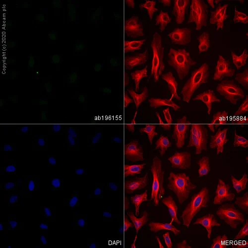 Immunocytochemistry/ Immunofluorescence - Alexa Fluor® 488 Anti-Nanog antibody [EPR2027(2)] (AB196155)