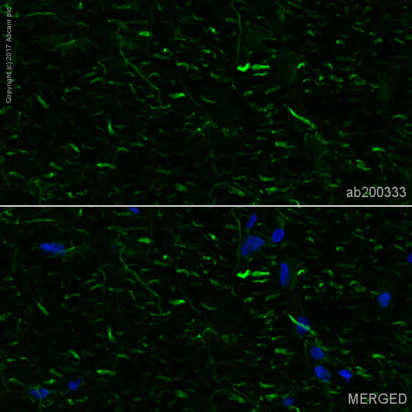Immunohistochemistry (Frozen sections) - Alexa Fluor® 488 Anti-NCAM1 antibody [EPR2566] (AB200333)