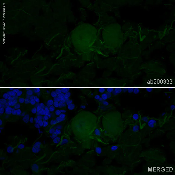 Immunohistochemistry (Frozen sections) - Alexa Fluor® 488 Anti-NCAM1 antibody [EPR2566] (AB200333)