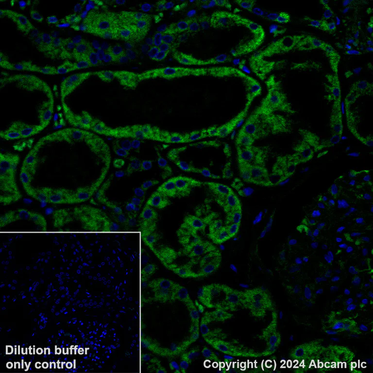 Immunohistochemistry (Formalin/PFA-fixed paraffin-embedded sections) - Alexa Fluor® 488 Anti-NDUFB8 antibody [EPR15961] (AB319009)