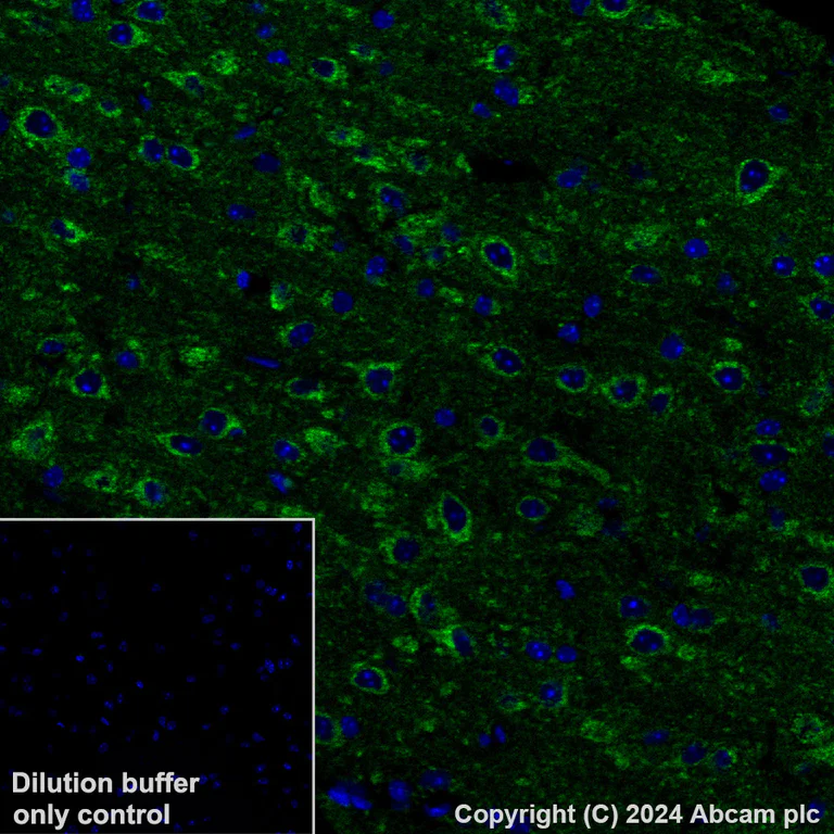 Immunohistochemistry (Formalin/PFA-fixed paraffin-embedded sections) - Alexa Fluor® 488 Anti-NDUFB8 antibody [EPR15961] (AB319009)