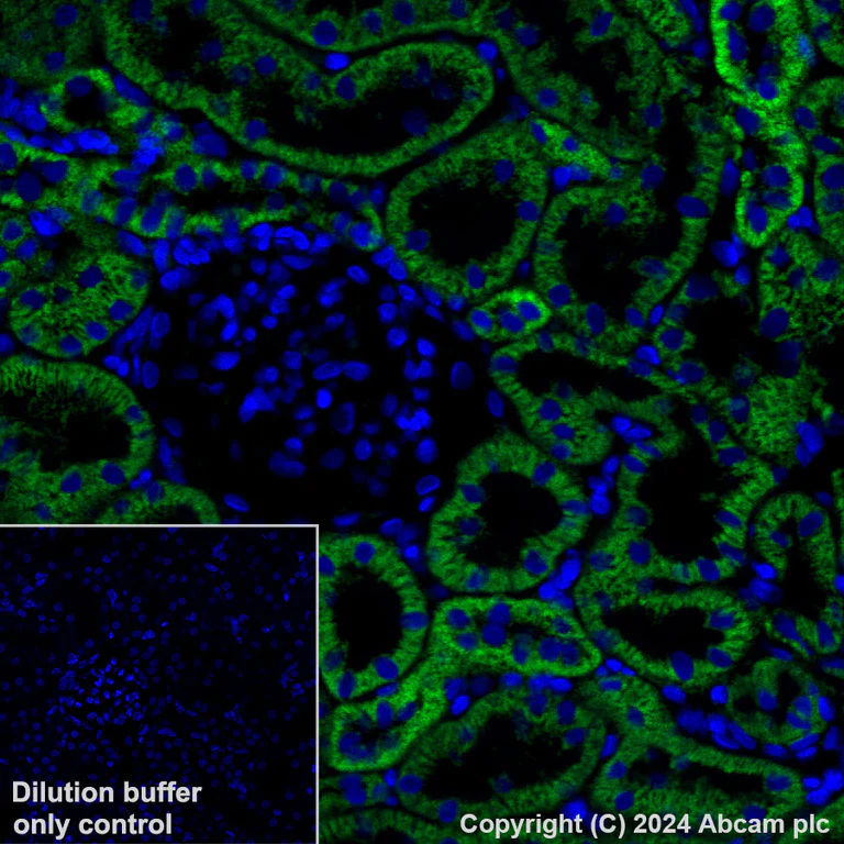 Immunohistochemistry (Formalin/PFA-fixed paraffin-embedded sections) - Alexa Fluor® 488 Anti-NDUFB8 antibody [EPR15961] (AB319009)