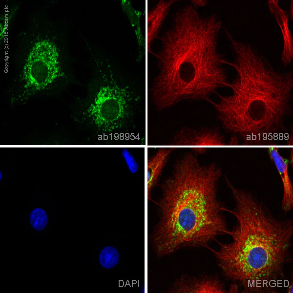 Immunocytochemistry/ Immunofluorescence - Alexa Fluor® 488 Anti-Ndufs1 antibody [EPR11521(B)] (AB198954)