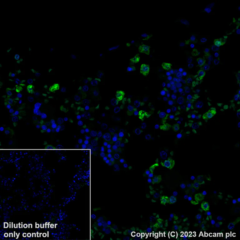 Immunohistochemistry (Formalin/PFA-fixed paraffin-embedded sections) - Alexa Fluor® 488 Anti-Neutrophil Elastase antibody [EPR7479] (AB317069)