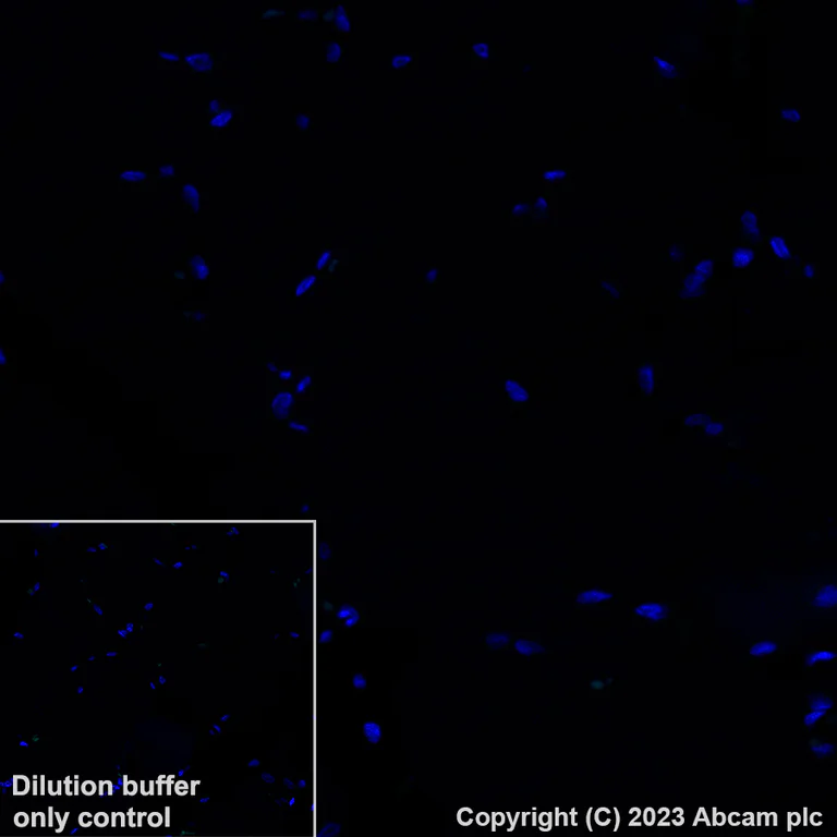 Immunohistochemistry (Formalin/PFA-fixed paraffin-embedded sections) - Alexa Fluor® 488 Anti-Neutrophil Elastase antibody [EPR7479] (AB317069)