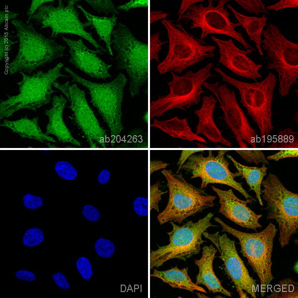 Immunocytochemistry/ Immunofluorescence - Alexa Fluor® 488 Anti-NF-kB p65 antibody [EP2161Y] (AB204263), expandable thumbnail