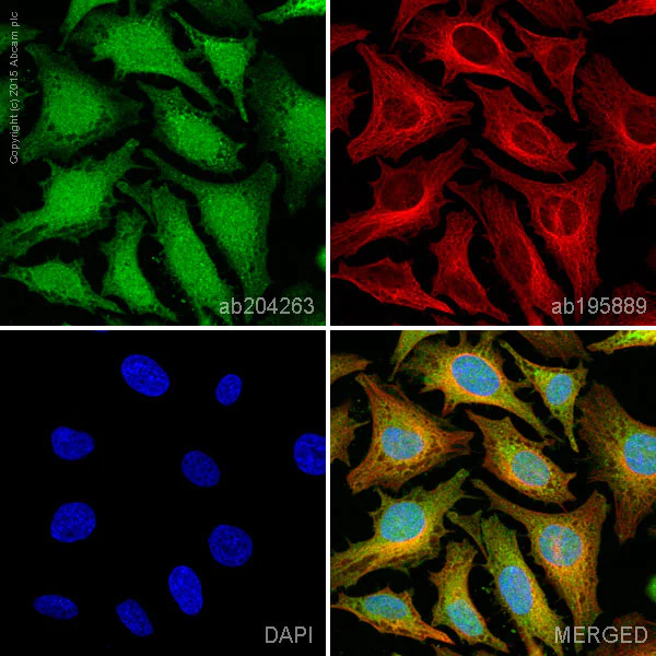 Immunocytochemistry/ Immunofluorescence - Alexa Fluor® 488 Anti-NF-kB p65 antibody [EP2161Y] (AB204263)
