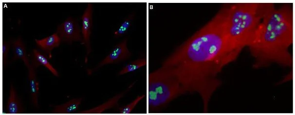 Immunocytochemistry/ Immunofluorescence - Alexa Fluor® 488 Anti-Nucleolin antibody [364-5] (AB154028)
