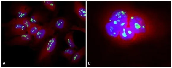 Immunocytochemistry/ Immunofluorescence - Alexa Fluor® 488 Anti-Nucleolin antibody [364-5] (AB154028)