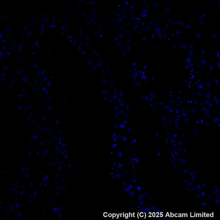 Immunohistochemistry (Formalin/PFA-fixed paraffin-embedded sections) - Alexa Fluor® 488 Anti-OLFM4 antibody [EPR29030-1] (AB324332)
