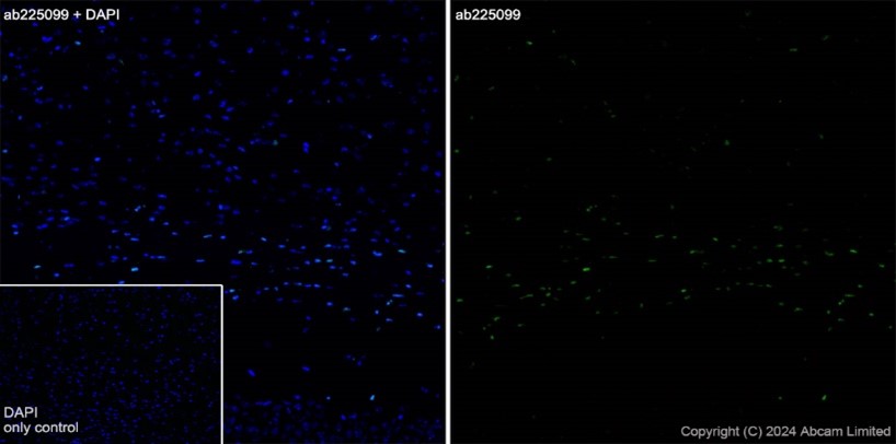 Immunohistochemistry (Frozen sections) - Alexa Fluor® 488 Anti-Olig2 antibody [EPR2673] (AB225099), expandable thumbnail