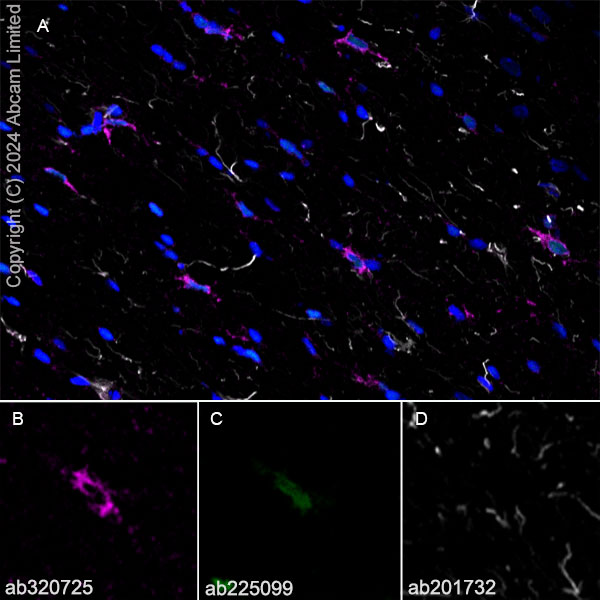 Immunohistochemistry (Frozen sections) - Alexa Fluor® 488 Anti-Olig2 antibody [EPR2673] (AB225099), expandable thumbnail