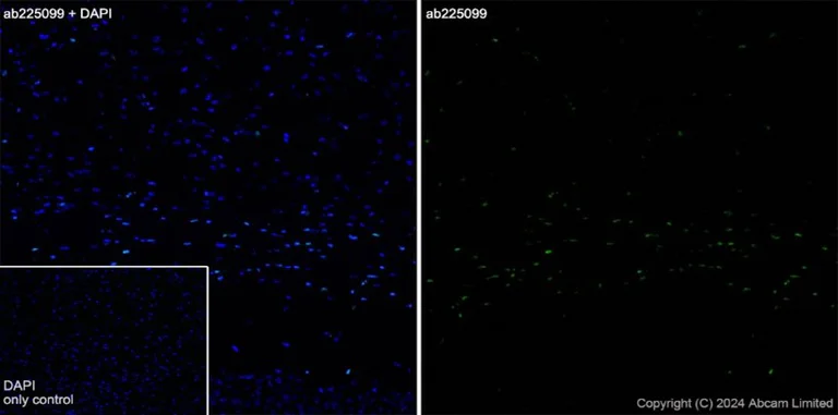 Immunohistochemistry (Frozen sections) - Alexa Fluor® 488 Anti-Olig2 antibody [EPR2673] - Oligodendrocyte Marker (AB225099)