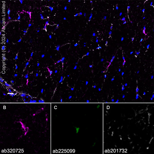 Immunohistochemistry (Frozen sections) - Alexa Fluor® 488 Anti-Olig2 antibody [EPR2673] - Oligodendrocyte Marker (AB225099)