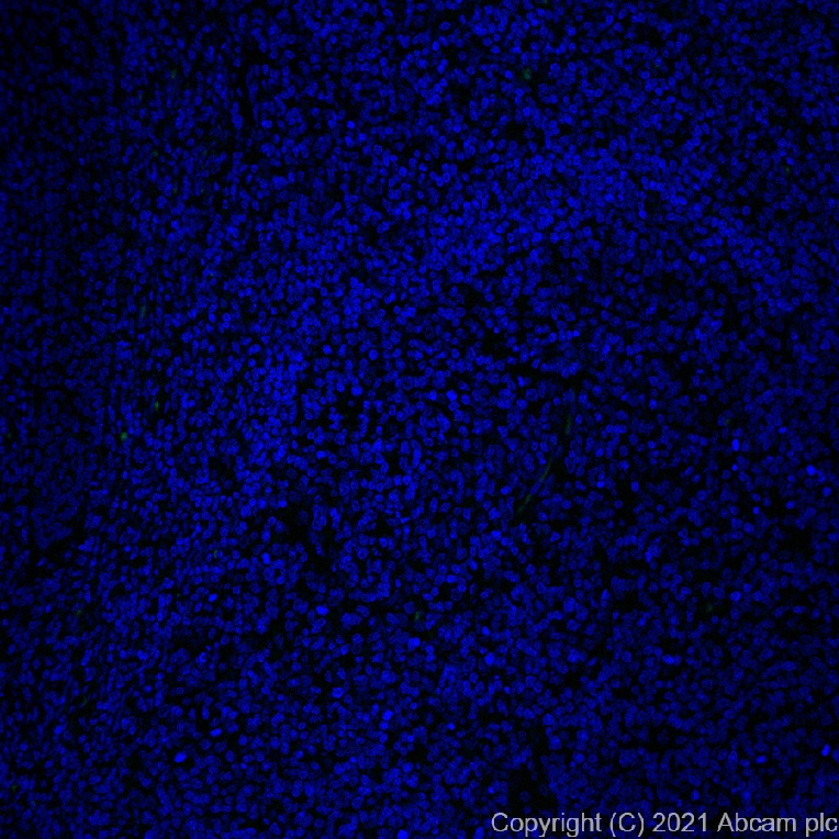 Immunohistochemistry (Formalin/PFA-fixed paraffin-embedded sections) - Alexa Fluor® 488 Anti-Osteopontin antibody [EPR21139-316] (AB282004), expandable thumbnail
