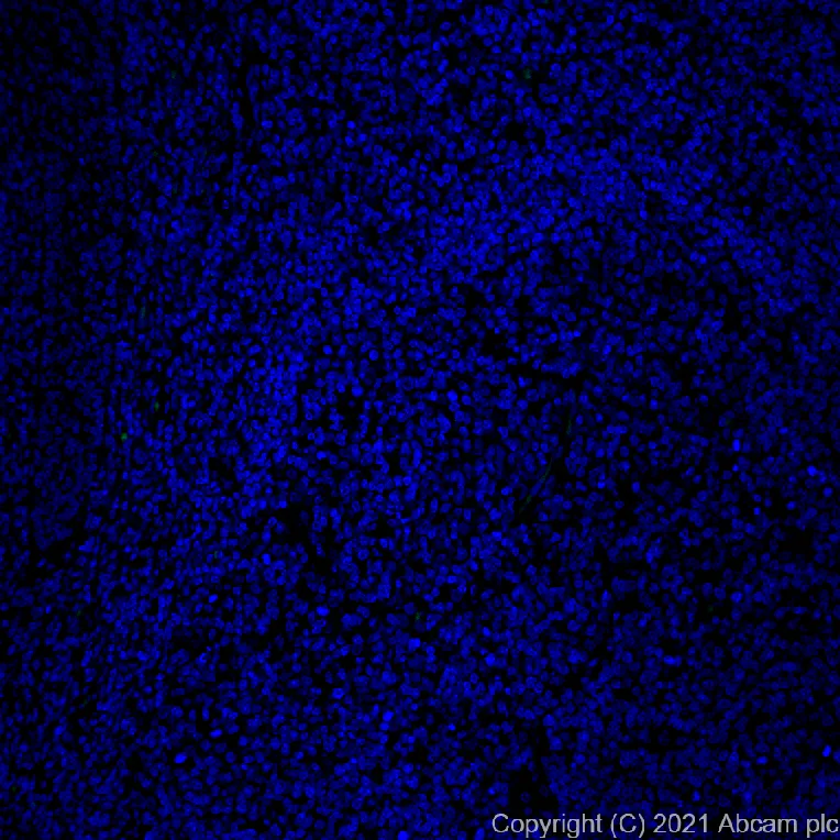 Immunohistochemistry (Formalin/PFA-fixed paraffin-embedded sections) - Alexa Fluor® 488 Anti-Osteopontin antibody [EPR21139-316] (AB282004)