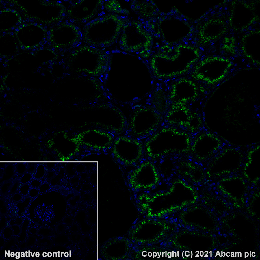 Immunohistochemistry (Formalin/PFA-fixed paraffin-embedded sections) - Alexa Fluor® 488 Anti-Osteopontin antibody [EPR21139-316] (AB282004), expandable thumbnail