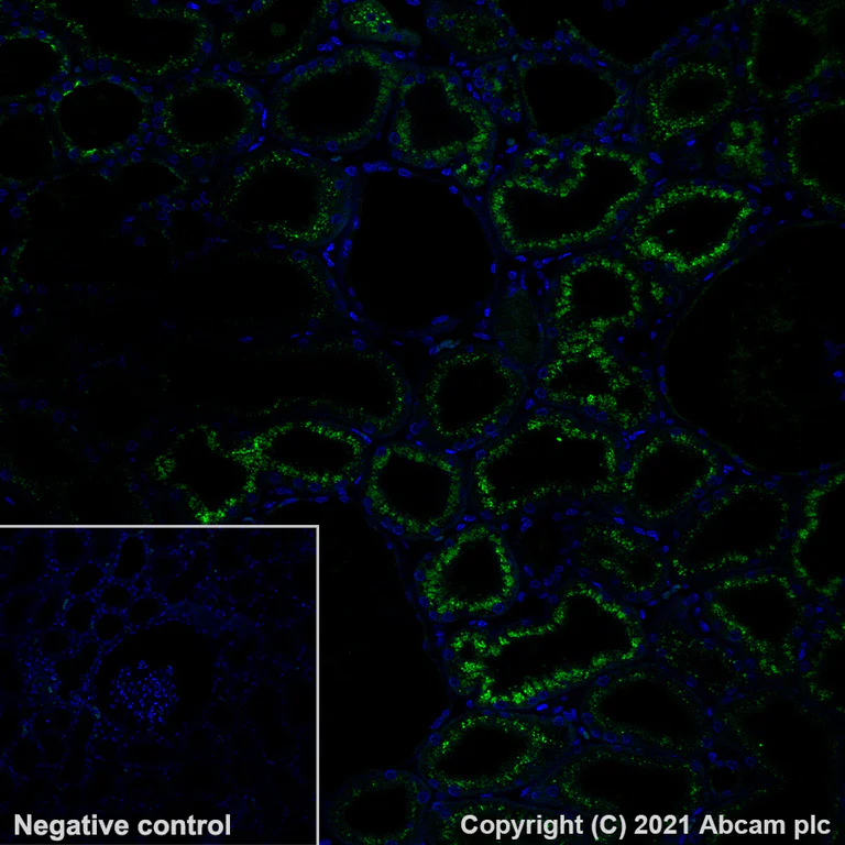 Immunohistochemistry (Formalin/PFA-fixed paraffin-embedded sections) - Alexa Fluor® 488 Anti-Osteopontin antibody [EPR21139-316] (AB282004)