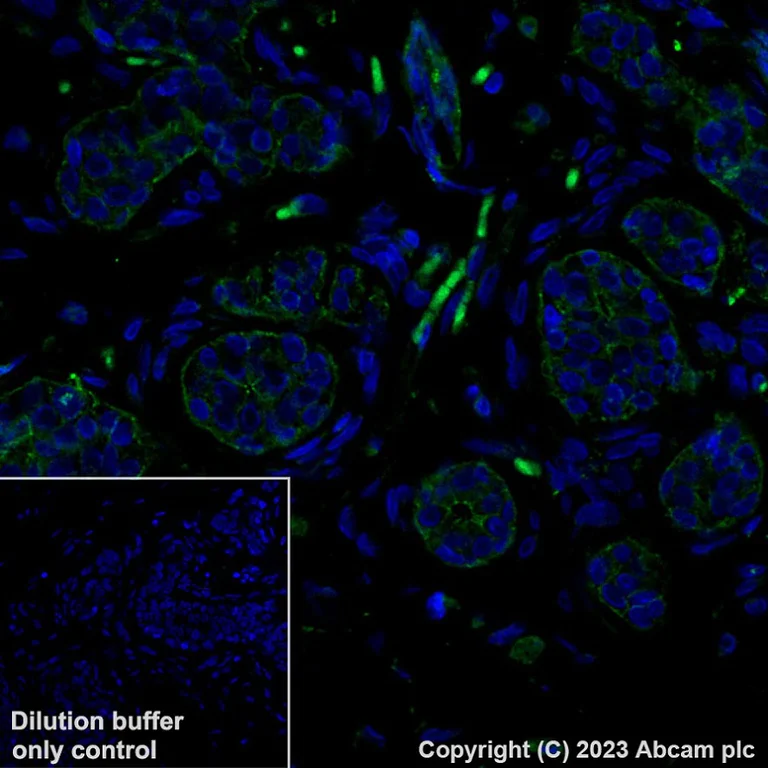 Immunohistochemistry (Formalin/PFA-fixed paraffin-embedded sections) - Alexa Fluor® 488 Anti-P cadherin antibody [EPR22426] (AB315259)