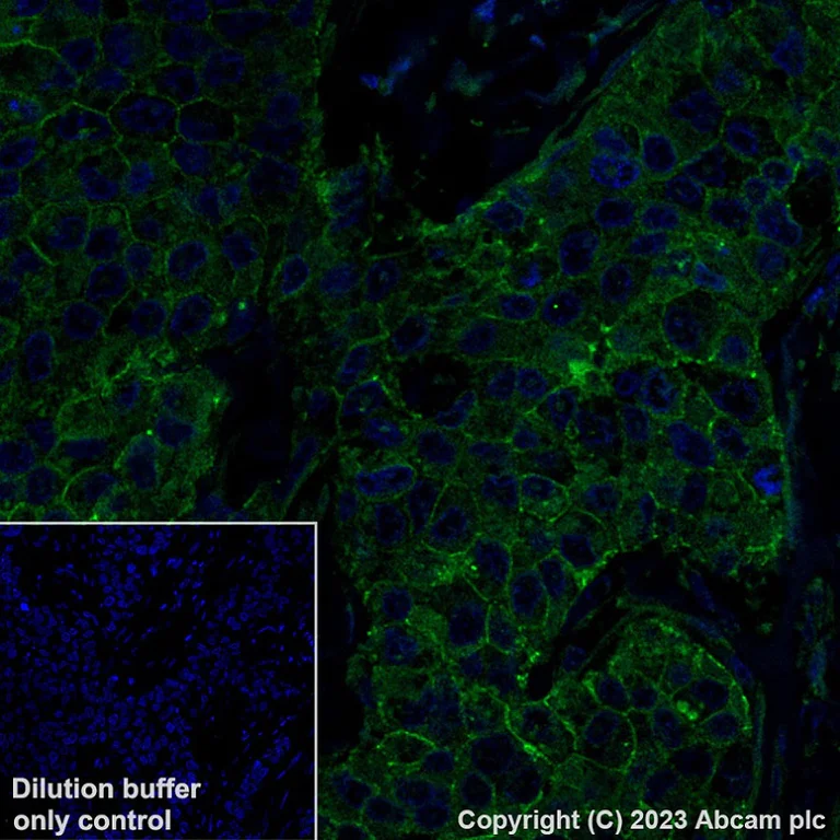 Immunohistochemistry (Formalin/PFA-fixed paraffin-embedded sections) - Alexa Fluor® 488 Anti-P cadherin antibody [EPR22426] (AB315259)