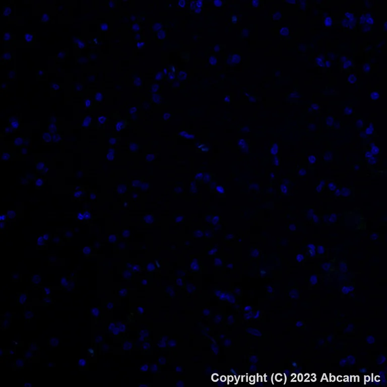 Immunohistochemistry (Formalin/PFA-fixed paraffin-embedded sections) - Alexa Fluor® 488 Anti-P cadherin antibody [EPR22426] (AB315259)