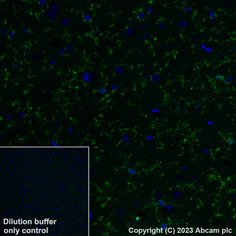 Immunohistochemistry (Formalin/PFA-fixed paraffin-embedded sections) - Alexa Fluor® 488 Anti-P2Y12 antibody [EPR26298-93] (AB309607), expandable thumbnail