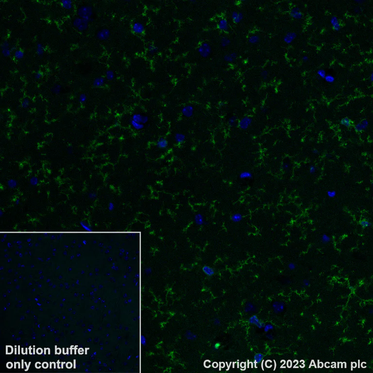 Immunohistochemistry (Formalin/PFA-fixed paraffin-embedded sections) - Alexa Fluor® 488 Anti-P2Y12 antibody [EPR26298-93] (AB309607)