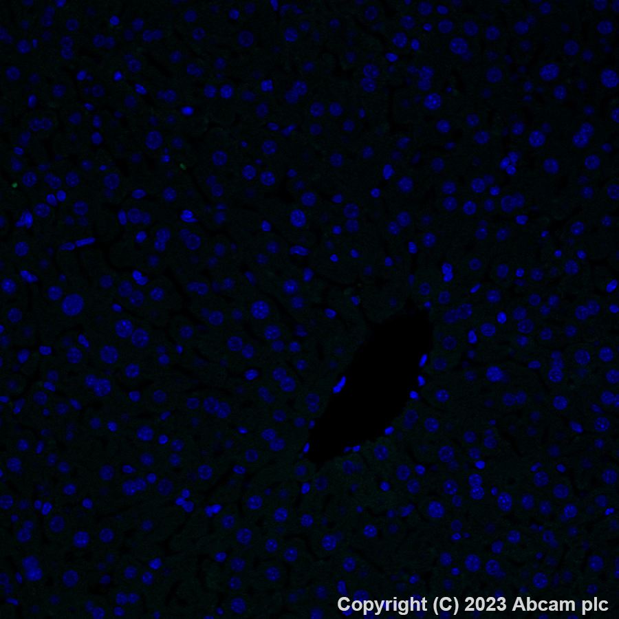 Immunohistochemistry (Formalin/PFA-fixed paraffin-embedded sections) - Alexa Fluor® 488 Anti-P2Y12 antibody [EPR26298-93] (AB309607), expandable thumbnail