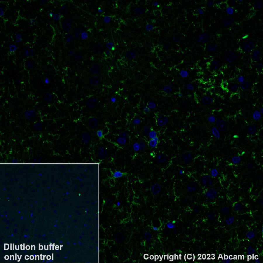 Immunohistochemistry (Formalin/PFA-fixed paraffin-embedded sections) - Alexa Fluor® 488 Anti-P2Y12 antibody [EPR26298-93] (AB309607), expandable thumbnail