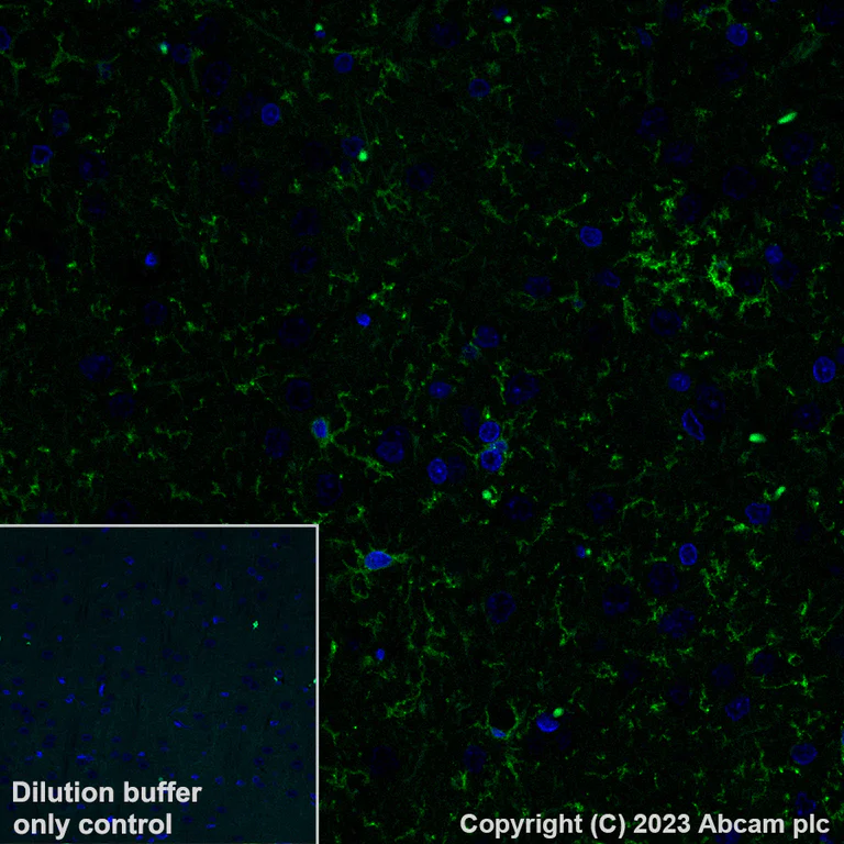 Immunohistochemistry (Formalin/PFA-fixed paraffin-embedded sections) - Alexa Fluor® 488 Anti-P2Y12 antibody [EPR26298-93] (AB309607)