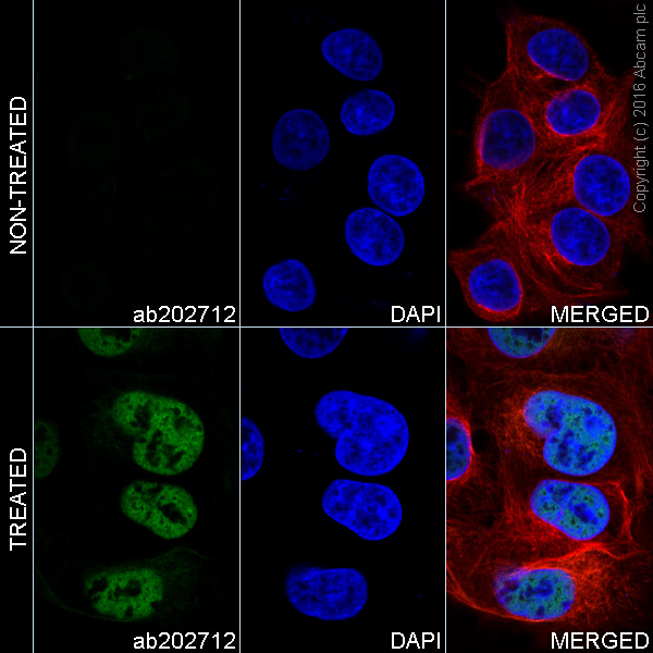 Immunocytochemistry/ Immunofluorescence - Alexa Fluor® 488 Anti-p53 (acetyl K370) antibody [EPR17496] (AB202712), expandable thumbnail