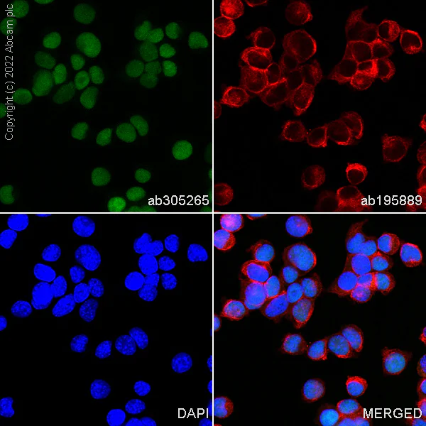 Immunocytochemistry/ Immunofluorescence - Alexa Fluor® 488 Anti-p53 antibody [EPR20416-120] (AB305265)