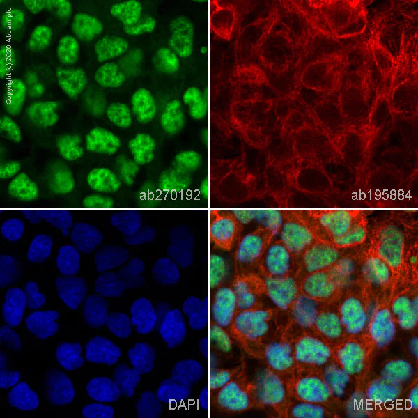 Immunocytochemistry/ Immunofluorescence - Alexa Fluor® 488 Anti-p53 antibody [SP5] (AB270192)