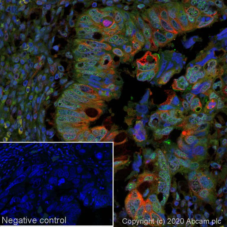 Immunohistochemistry (Formalin/PFA-fixed paraffin-embedded sections) - Alexa Fluor® 488 Anti-p53 antibody [SP5] (AB270192)