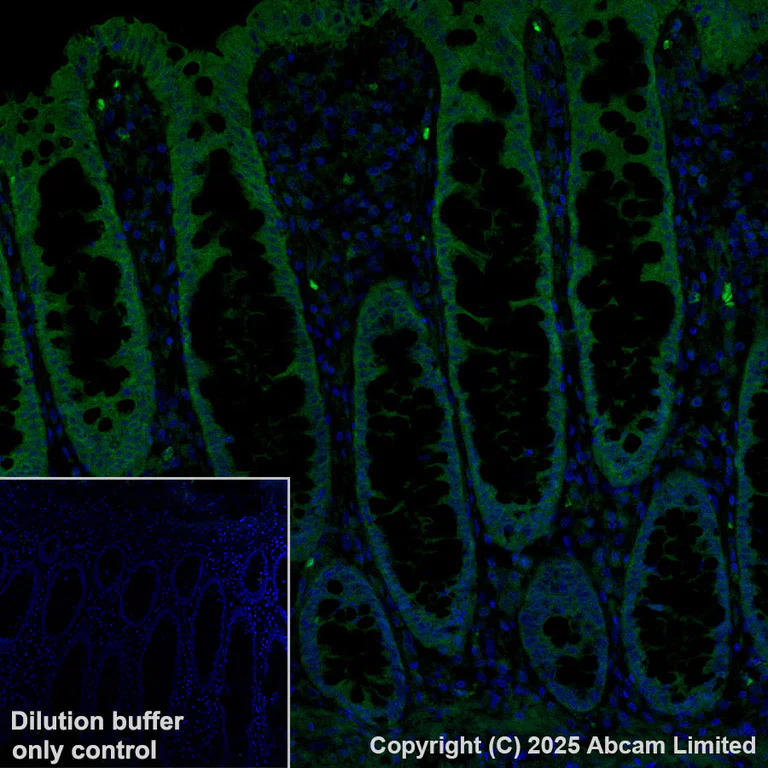 Immunohistochemistry (Formalin/PFA-fixed paraffin-embedded sections) - Alexa Fluor® 488 Anti-PADI2 / PAD2 antibody [EPR26940-85] (AB324331)